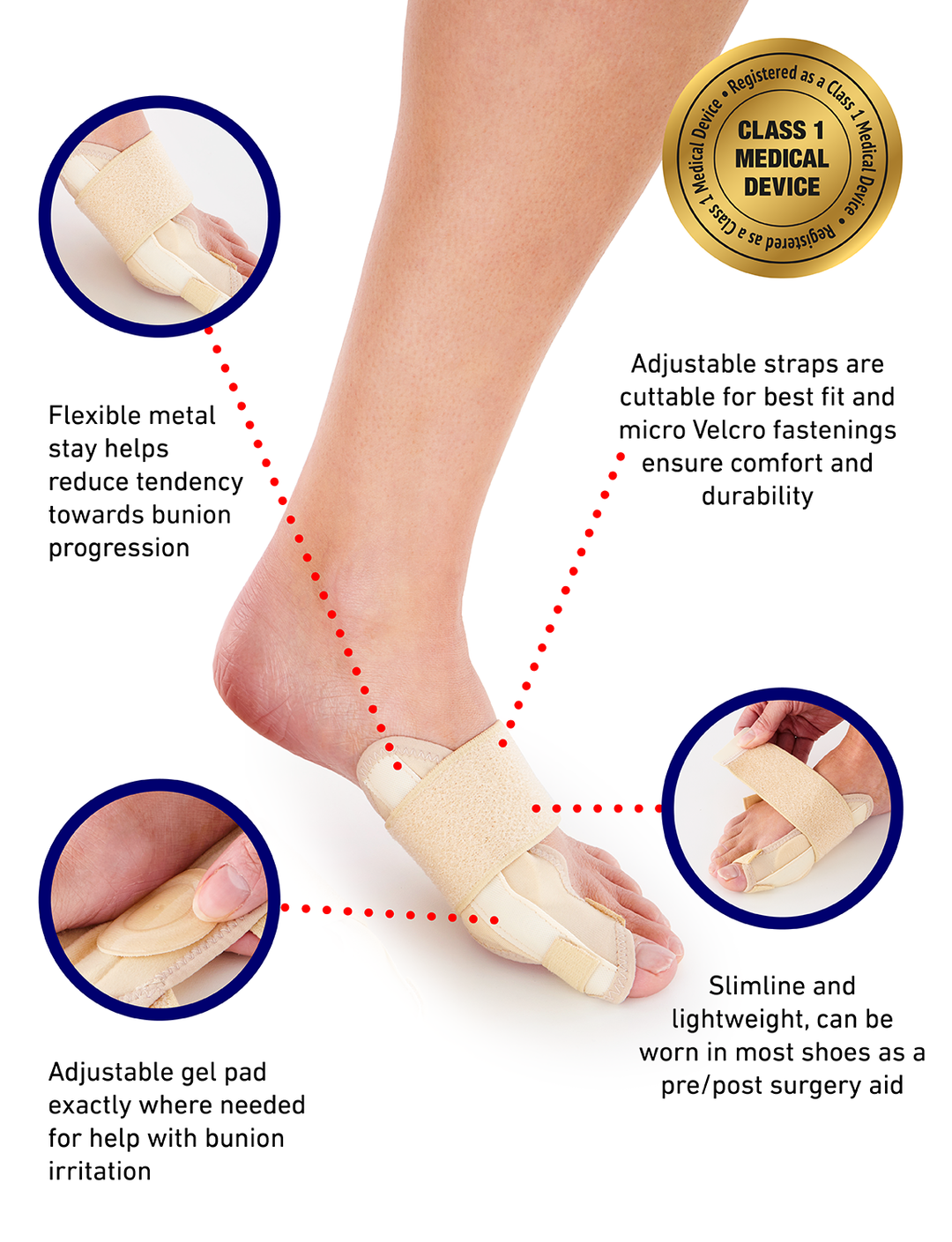 Hallux Valgus Best Insoles For Hallux Rigidus 1stRaythotics